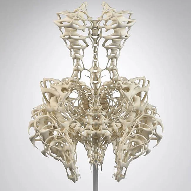 Skeleton Dress, Iris van Herpen